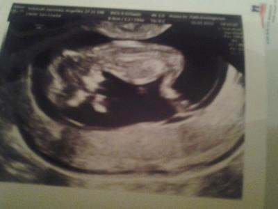 Bild zu FA Bericht :-) - Forum für August - Mamis