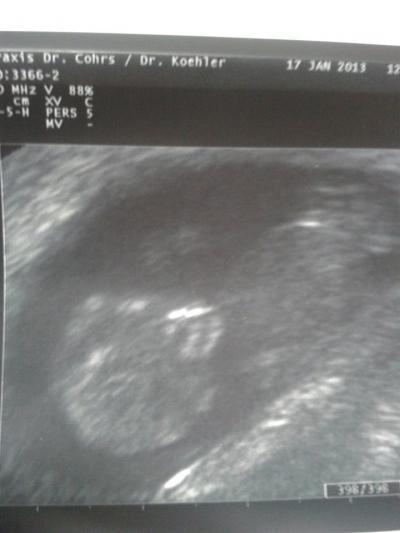 Bild zu Ich war auch bei der VU - Forum für August - Mamis