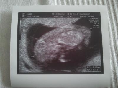 Bild zu baby bild :-) - Forum für August - Mamis
