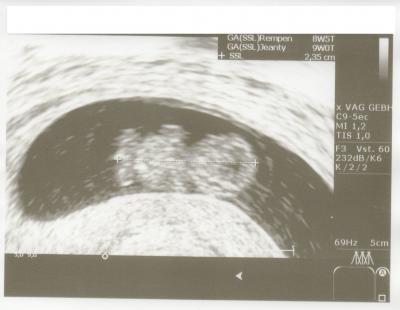 Bild zu Zu klein? - Forum für August - Mamis