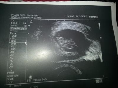 Bild zu Bildchen :)) - Forum für August - Mamis