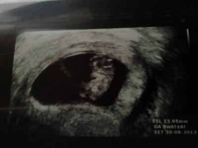 Bild zu versprochenes foto von meinem sonnenschein :-) - Forum für August - Mamis