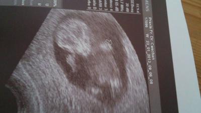 Bild zu Bild - Forum für August - Mamis