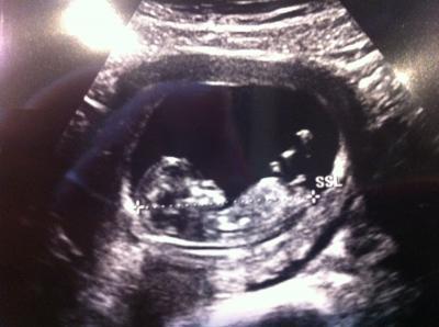 Bild zu Juhu - Forum für August - Mamis