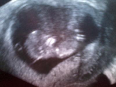 Bild zu Frauenarztbericht - Forum für August - Mamis