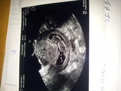 Bild zu zurück vom FA... - Forum für August - Mamis