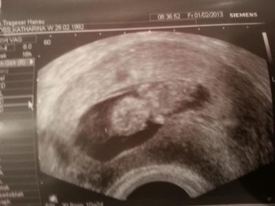 Bild zu FA Termin Bericht! - Forum für August - Mamis