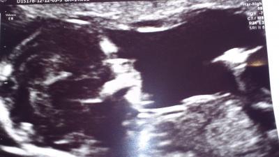 Bild zu Fa Bericht mit 85% Outing :-) - Forum für August - Mamis