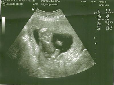 Bild zu Mein süßer Fratz - Forum für August - Mamis