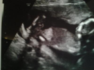 Bild zu FA Berich & Outing :-) - Forum für August - Mamis