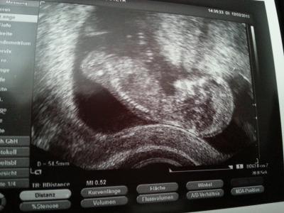 Bild zu Darf ich vorstellen.. - Forum für August - Mamis