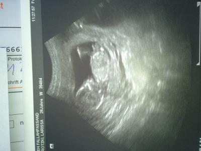 Bild zu Wollte euch mein Krümmel zeigen ;-) - Forum für August - Mamis