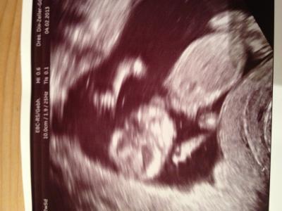 Bild zu Darf ich auch noch zu euch kommen ? - Forum für August - Mamis