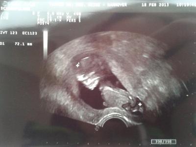 Bild zu Gyn- Termin :-) - Forum für August - Mamis