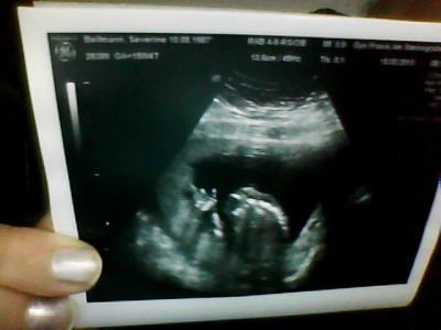 Bild zu Bilder - Forum für August - Mamis