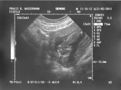 Bild zu FA termin von heute morgen - Forum für August - Mamis