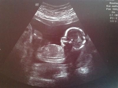 Bild zu Outing:) - Forum für August - Mamis