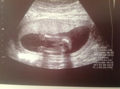 Bild zu Outing!!! - Forum für August - Mamis