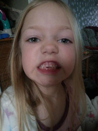 Bild zu Die zahnlose Dame :) - Forum für August - Mamis