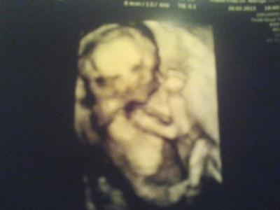 Bild zu augustmamis - Forum für August - Mamis