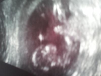 Bild zu FA Bericht - Forum für August - Mamis