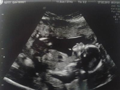 Bild zu Ich hab auch noch ein Bildchen - Forum für August - Mamis