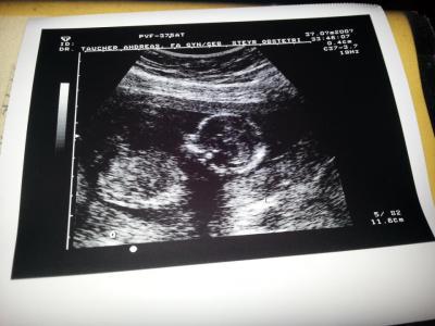 Bild zu Zurück vom Frauenarzt.. - Forum für August - Mamis