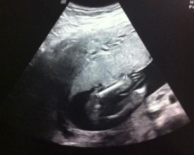 Bild zu Krankenhaus... - Forum für August - Mamis