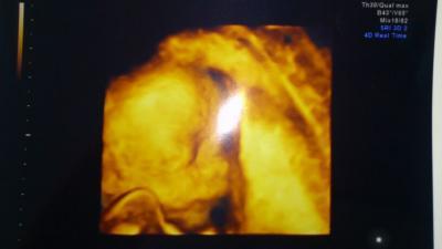 Bild zu Zurück von der FD :-) - Forum für August - Mamis