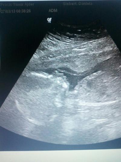 Bild zu Aktuelles Ultraschallbild ;-) - Forum für August - Mamis