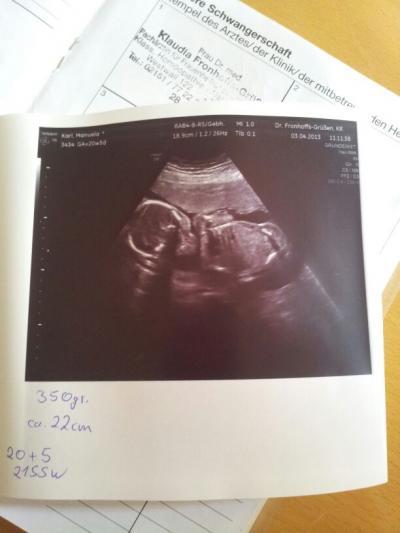 Bild zu Zurück vom FA +Bild - Forum für August - Mamis