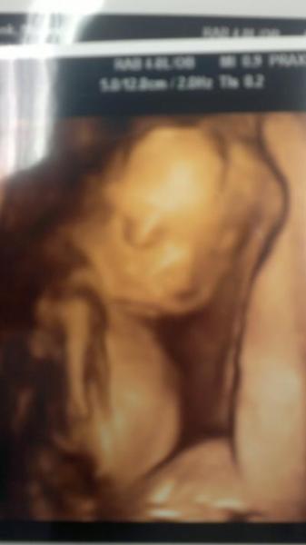 Bild zu FD geschafft+Foto - Forum für August - Mamis