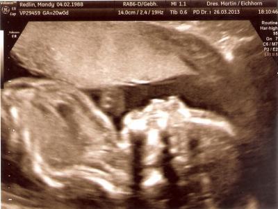 Bild zu neues Ultraschallbild von unserem Spatz - Forum für August - Mamis