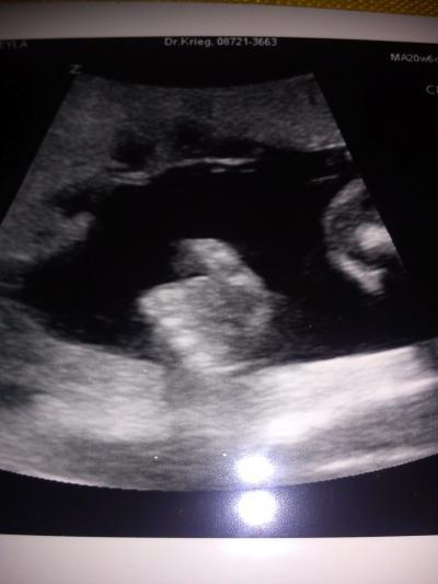 Bild zu Auch FA Bericht :) - Forum für August - Mamis