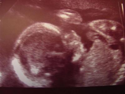 Bild zu So und nun auch was positives :) - Forum für August - Mamis