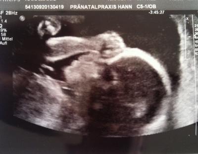 Bild zu Organ-Ultraschall (Bericht + Outing) - Forum für August - Mamis