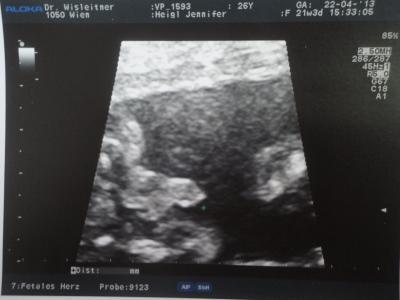 Bild zu Bericht Organscreening und eeeendlich ein OUTING :) - Forum für August - Mamis