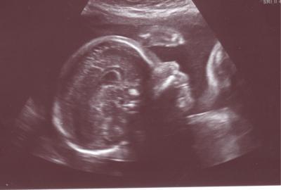 Bild zu Bericht 2. Teil - Forum für August - Mamis