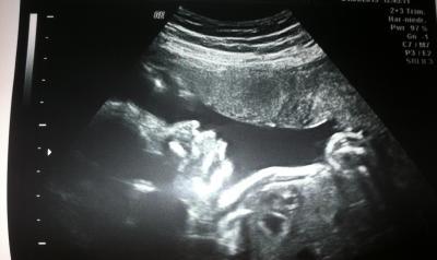Bild zu FA Besuch :-) ! - Forum für August - Mamis