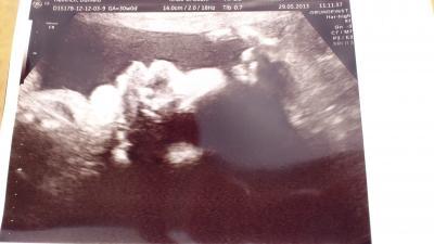 Bild zu Bericht vom 3 US und Foto :-) - Forum für August - Mamis