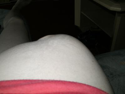 Bild zu Schaut mal bitte :) - Forum für August - Mamis
