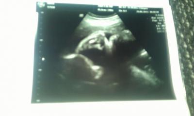 Bild zu mein schatzzz - Forum für August - Mamis