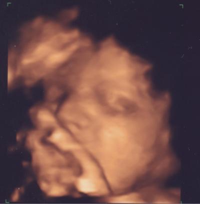 Bild zu Gespräch Geburtsplanung - Forum für August - Mamis