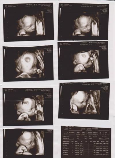 Bild zu Will auch endlich kuscheln :( - Forum für August - Mamis