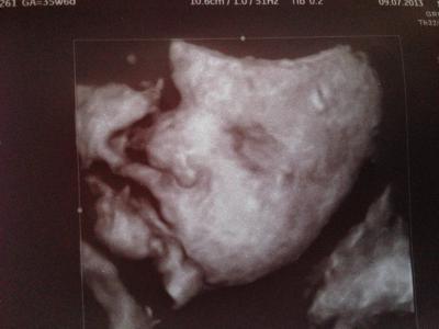 Bild zu Wollte auch mal meinen... - Forum für August - Mamis