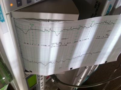 Bild zu Fehlalarm, ab nachhause :( - Forum für August - Mamis