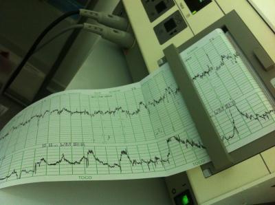 Bild zu Pieeeep heute ET & Bericht FA :-) - Forum für August - Mamis