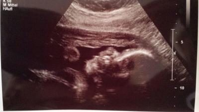 Bild zu Bericht von heute + Bild - Forum für August - Mamis