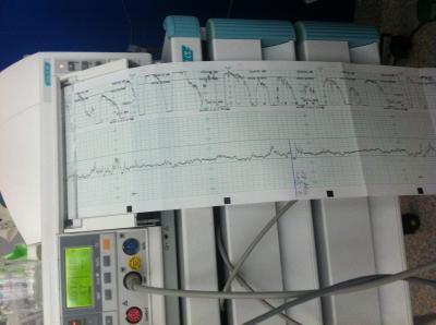 Bild zu Kurzes Update ' es geht voran! - Forum für August - Mamis