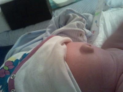 Bild zu Frage wegen Nabel - Forum für August - Mamis